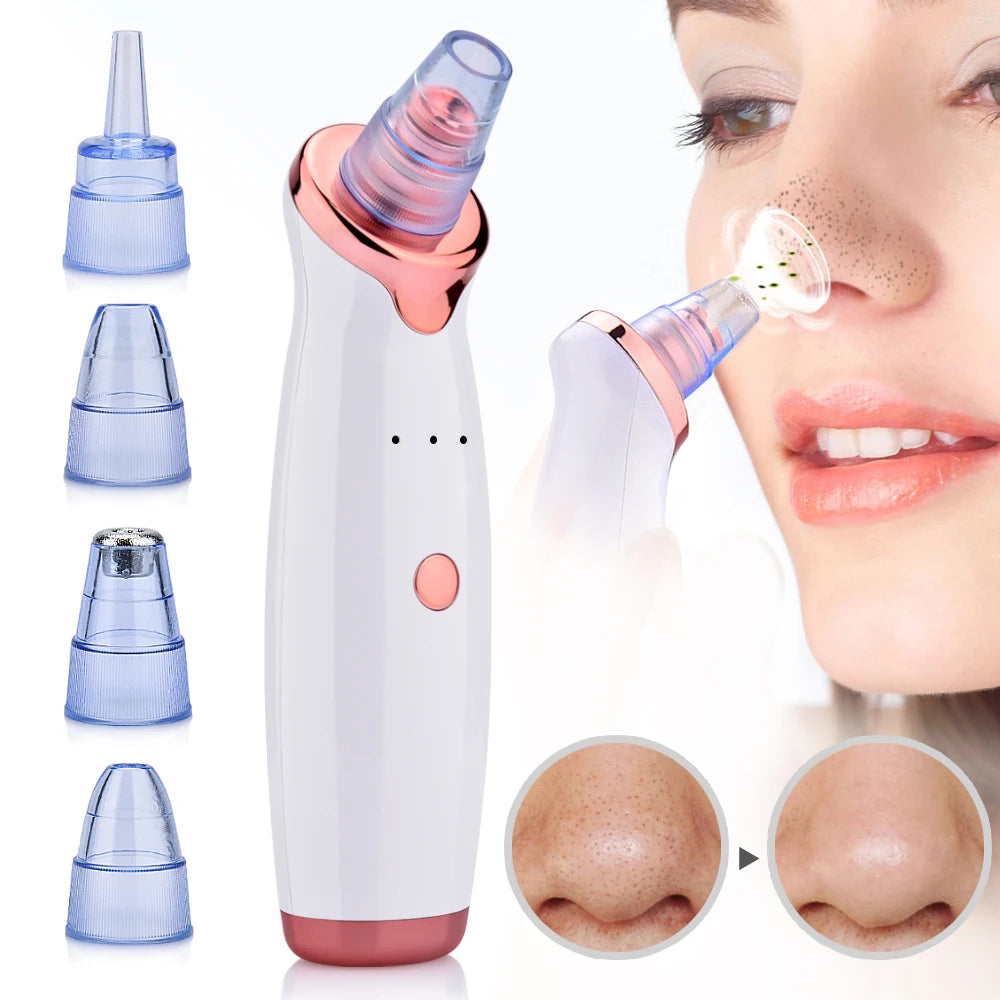 GlowClean – odkurzacz do zaskórników i trądziku 0