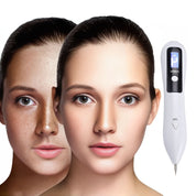 Laser plazmowy Clearskinpro – nieinwazyjny | Do usuwania piegów, narośli skórnych, plam, znamion i tatuaży w domu 3