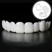 Natychmiastowa transformacja uśmiechu dzięki licówkom Snap on Smile 0