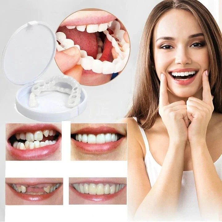 Natychmiastowa transformacja uśmiechu dzięki licówkom Snap on Smile 1