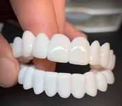 SmileFlex – protezy z białymi soczewkami zębowymi 0