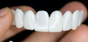 SmileFlex – protezy z białymi soczewkami zębowymi 3