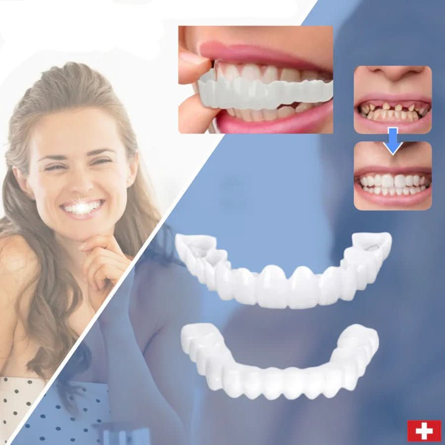 SnapFit Smile – odbudowa zębów dla idealnego uśmiechu bez wizyty u dentysty 0