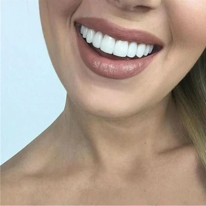 SnapFit Smile – odbudowa zębów dla idealnego uśmiechu bez wizyty u dentysty 2